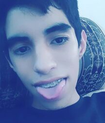 Braces I 5ec3eb2b27251.jpg