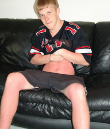 Mikey sun burned 5ed2d5cc2a09e.jpg