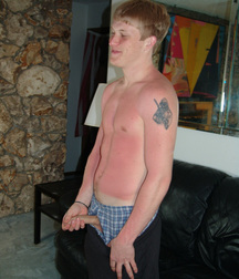 Mikey sun burned 5ed2d5e0526a6.jpg
