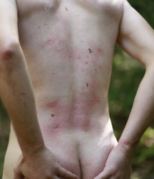 Outdoor Bondage Fetish Boys Porn 5f3ca22952f03.jpeg