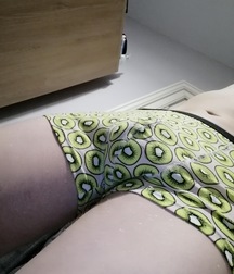 20YO 6’5” British Uncut Twink With Armpit Fetish Mega Album 62818f5a19162.jpeg