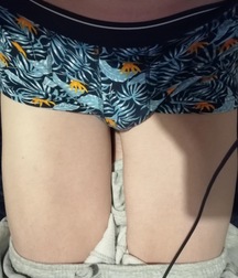 20YO 6’5” British Uncut Twink With Armpit Fetish Mega Album 628190c76033a.jpeg