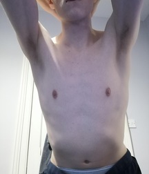 20YO 6’5” British Uncut Twink With Armpit Fetish Mega Album 6281915a81940.jpeg