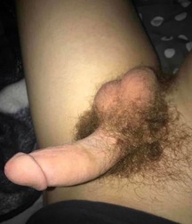 Hairy Bushes 2  5f6fe55b425a2.jpeg