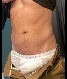 Bulges 3 5fa20853b62c2.png