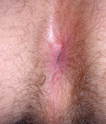 Cute Twink Porn Hunter-3 Gay 5f803dd5a0422.jpg