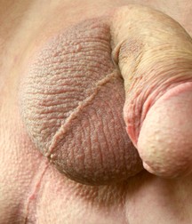 Flaccid dicks 576b34cff272c.jpg