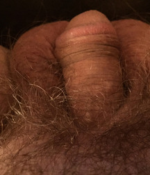Flaccid dicks 576b366abe3bc.jpg