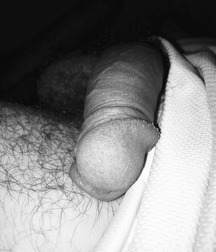 Flaccid dicks 576b37418aab2.jpg