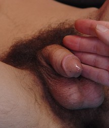 Circumcision (huge gallery) 586fa4c92d559.jpg
