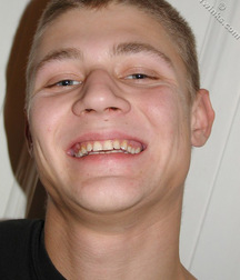 Gay Teen Porn Tube Akim Boys 60d28912743e7.jpg