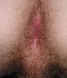 Gay Teen Porn Tube Akim Boys 60d28a67a3069.jpg