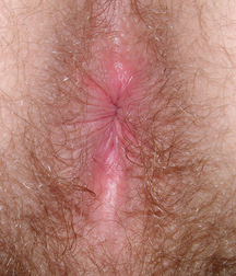 Gay Teen Porn Tube Akim Boys 60d28a6a2aae8.jpg