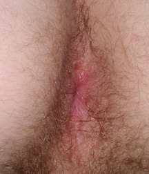 Gay Teen Porn Tube Akim Boys 60d28a6c84b70.jpg