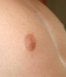 Gay Porn Tube Feodor Teen Boys 612f80c6deaeb.jpg