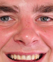 Gay Boys Teen 621a352f8a6f6.jpg