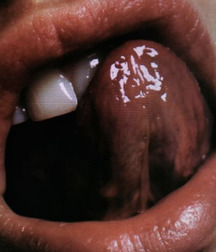 zoomin' oral 59dcdcf6abf9d.jpg