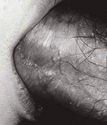 zoomin' oral 59dcdcf95c5a1.jpg