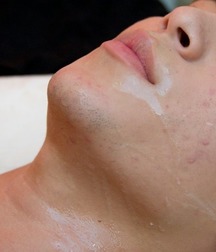on the face
