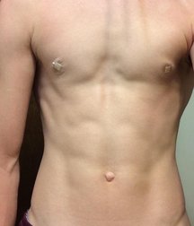 terrific tight tummies 5ae5d8ed05121.jpg