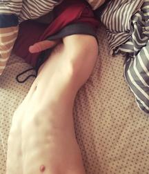 swollen 5cd37d279ecf7.jpg