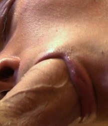 oral zoomed in 5d1aa05006542.jpg