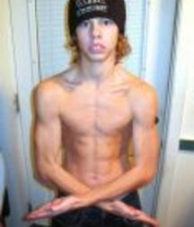 gay tube topless moptops 5ef3881da6c2e.jpg