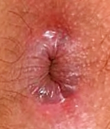Hot asses and hotter holes - 1 - Closeup Gay Tube 60c78463b5395.jpg