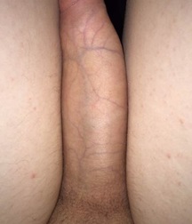 Beautiful teen dicks 01 59a3536c6c4b8.jpg