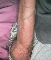 Beautiful Teen Dicks Big Hung Pictures Gay Porn 621ff6c0dbe1a.jpg