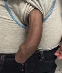 Beautiful Teen Dicks Pop Out Twink Tube Porn 62200a4d166e6.jpg