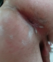 Hung teen boys uncut cock 6244ff1535af4.jpg