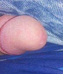 Me 571e5f0901910.jpg