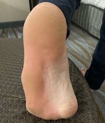 Gay porn young barefoot fetish  61f41f0bca0b4.jpg