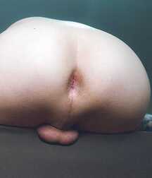 A beautiful story of buttocks boys gay porn nude skin 620889b65e1ce.jpg