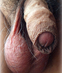 Uncut flaccid penises of various types cocks boys porn 626d6aceb526e.jpg