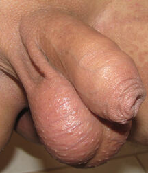 Uncut flaccid penises of various types cocks boys porn 626d6b6a9c84e.jpg