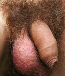 Uncut flaccid penises of various types cocks boys porn 626d6c8147a8f.jpg