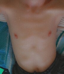 Hottis twink porn tube 62dcdee90df67.jpg