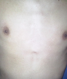 Gilber my friend teen 18 years  59972f5231ac3.jpg