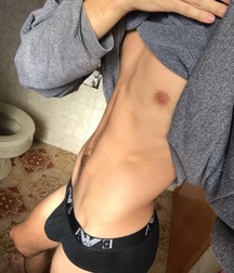 Lumps and Bumps 5a3d32a953e3c.jpg
