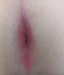 It's a Hole  619a65fa63c76.jpg