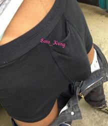 Lumps and Bumps  61c1f00bad5fb.jpg