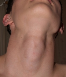 Hot And Horny Boy 59e76f71bae1b.jpg