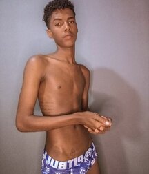 Slim Skinny Selfie Twink Outdoors Tight Porn 62d2e154eb90d.jpg
