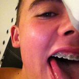 Boys With Braces 5.jpg