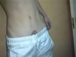 My self