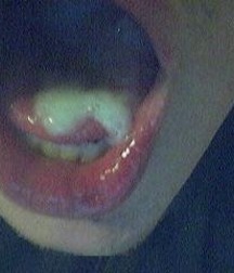 FCS - The White Stuff