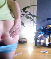My butthole :D! 563ad5d4ae9b1.jpg