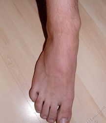 Albert (Full-Set) Beautiful Left-Curving Mantool 5b2f204c6387f.jpg